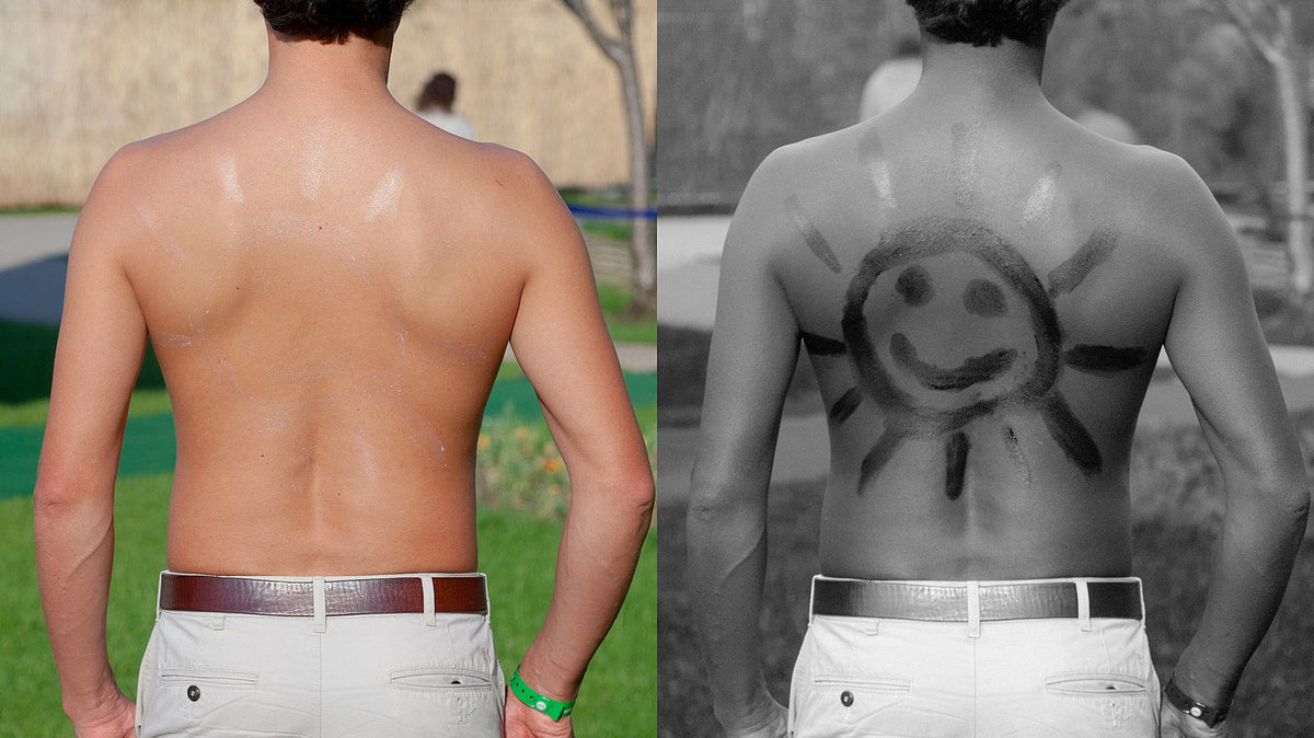 Sunscreen on a man's back under normal and UV light