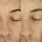 Noble Panacea Overnight Chronobiology Peel