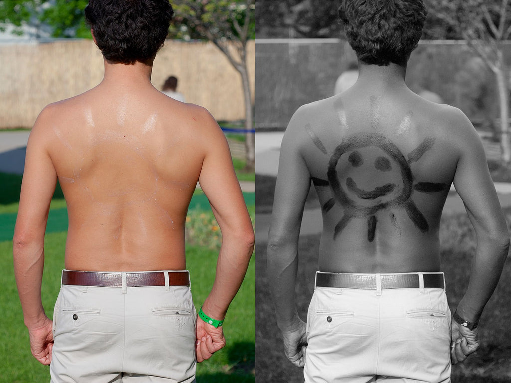 Sunscreen on a man's back under normal and UV light