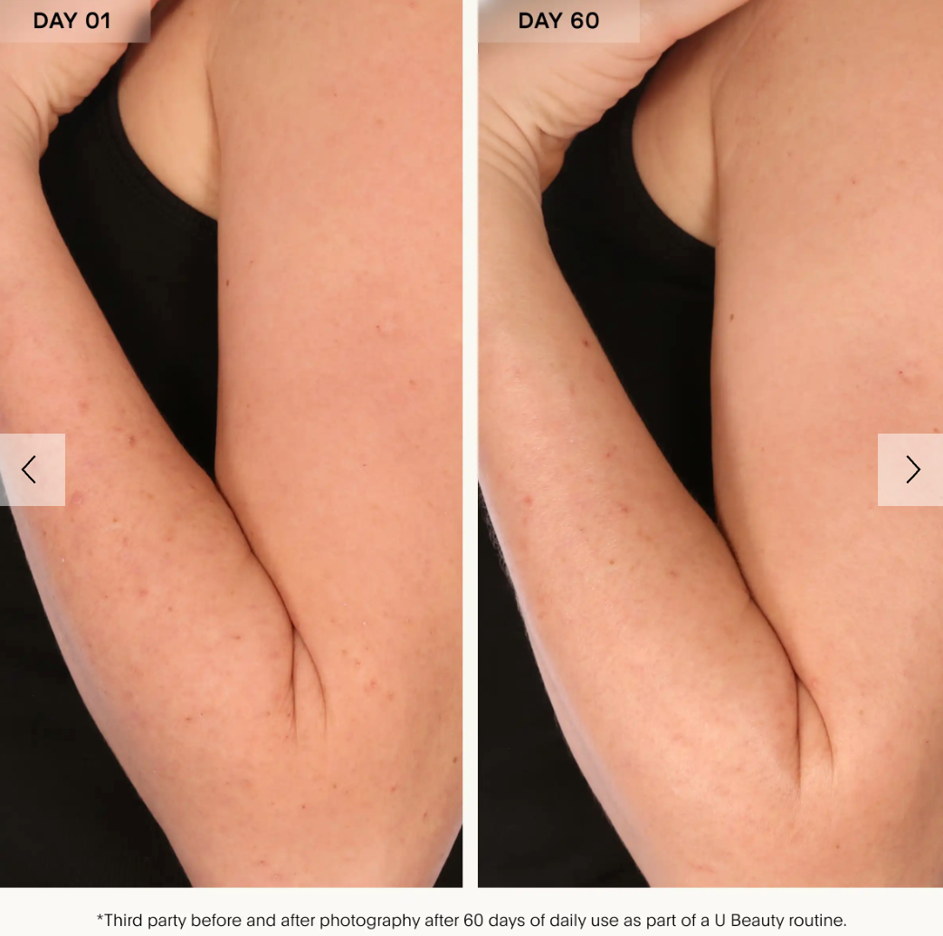 U Beauty Resurfacing Body Compound