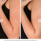U Beauty Resurfacing Body Compound